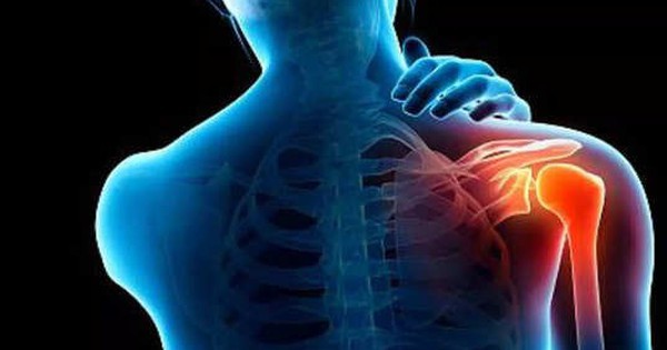 Bài tập nào giảm đau vai nhanh? 2 bai tap nao giam dau vai nhanh 6928335a88653