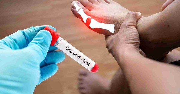 5 loai do uong khi doi giup ha axit uric cao 69412a365368c