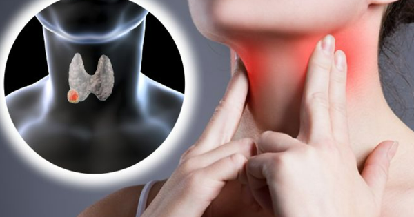 chuyen gia chi cach on dinh nhan tuyen giap khong to len khong bien chung 6964c20974493