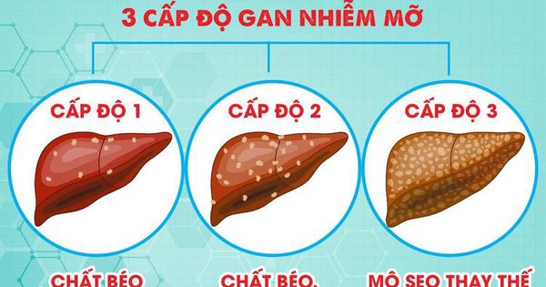 hai cach don gian giup bao ve gan khoe manh moi ngay 695641d4afb6d